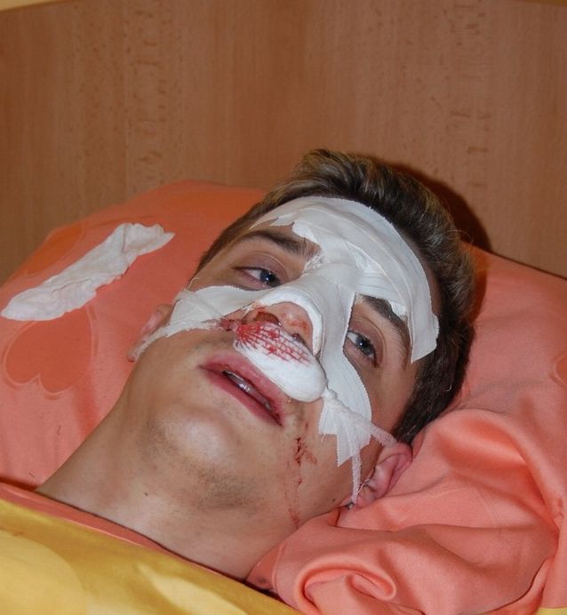 Slika
